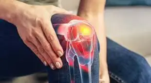 Joint pain treatment